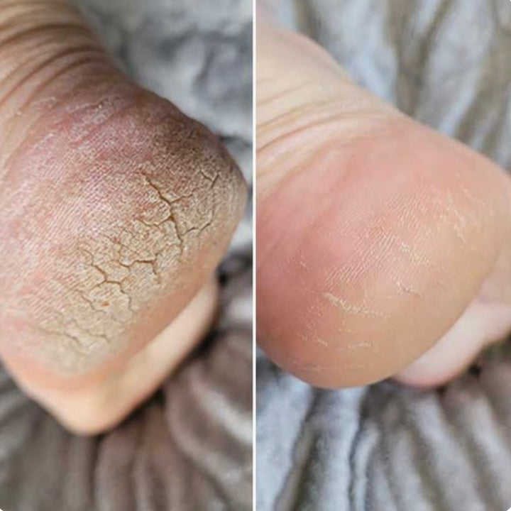 Electric Foot Grinder